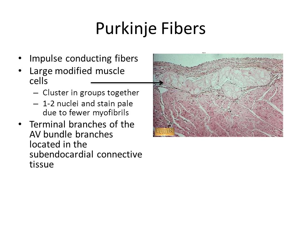 Purkinje Fibers Histology